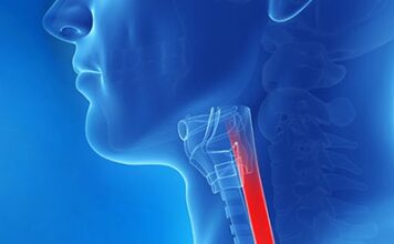 FDA revisión primera terapia esofagitis eosinofílica
