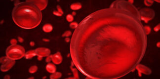 Iptacopan designación terapia innovadora hemoglobinuria paroxística nocturna