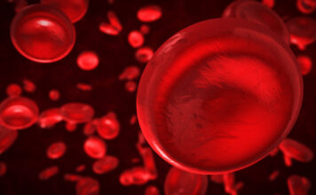 Iptacopan designación terapia innovadora hemoglobinuria paroxística nocturna