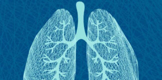 Prolargin biomarcador hipertensión arterial pulmonar