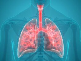¿Te agotas fácilmente? Podría ser por la hipertensión arterial pulmonar
