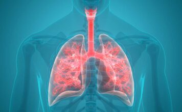 ¿Te agotas fácilmente? Podría ser por la hipertensión arterial pulmonar