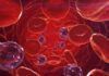 hemoglobina fetal, tratar anemia falciforme
