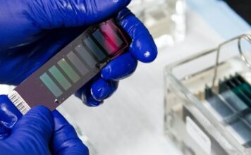 métodos medir actividad de C1-INH angioedema herediatrio