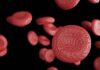 terapia genética reduce hemorragia hemofilia A ensayo de fase 3