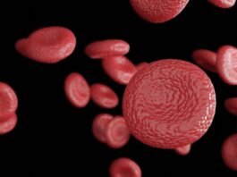 terapia genética reduce hemorragia hemofilia A ensayo de fase 3