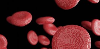 terapia genética reduce hemorragia hemofilia A ensayo de fase 3