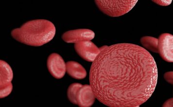 terapia genética reduce hemorragia hemofilia A ensayo de fase 3