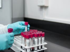 GeneDx está ampliando las pruebas genéticas para las formas de ataxia hereditaria