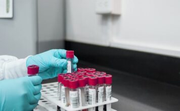 GeneDx está ampliando las pruebas genéticas para las formas de ataxia hereditaria