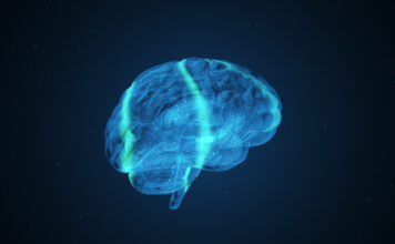 Lamina B1 contribuye a la neurodegeneración en la enfermedad de Huntington