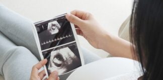 Uso del inhibidor de C1 puede prevenir de manera segura ataques de angioedema hereditario en mujeres embarazadas