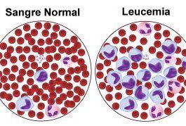 Leucoblastos: qué son y cómo se relacionan con otras células en la leucemia