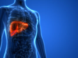 El carcinoma hepatocelular de origen no vírico tiene peor respuesta al tratamiento con inmunoterapia