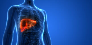 El carcinoma hepatocelular de origen no vírico tiene peor respuesta al tratamiento con inmunoterapia