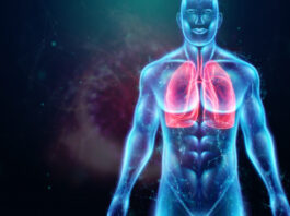 La inmunoterapia con durvalumab pasa al ensayo de fase 3 para el mesotelioma pleural maligno