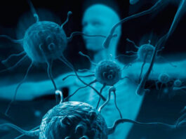 Abril es el mes de concientización sobre el síndrome de Sjögren