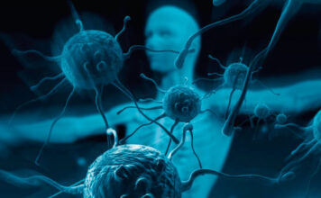 Abril es el mes de concientización sobre el síndrome de Sjögren