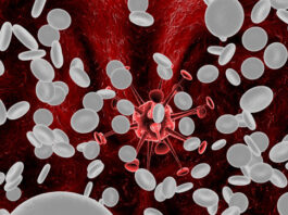 La leucemia mieloide crónica se convierte en una categoría de enfermedades