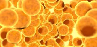 Una firma molecular en las células hepáticas sometidas a estrés proporciona a los pacientes con CEP una nueva pista sobre su enfermedad
