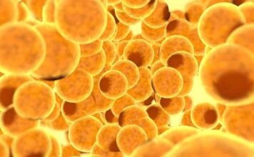 Una firma molecular en las células hepáticas sometidas a estrés proporciona a los pacientes con CEP una nueva pista sobre su enfermedad