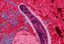 Vacuna contra la malaria de Oxford se prepara para la prueba de fase 3 después de una eficacia del 77% "sin precedentes"