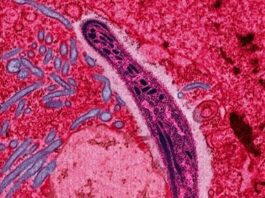 Vacuna contra la malaria de Oxford se prepara para la prueba de fase 3 después de una eficacia del 77% "sin precedentes"