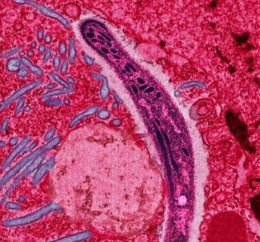 Vacuna contra la malaria de Oxford se prepara para la prueba de fase 3 después de una eficacia del 77% 