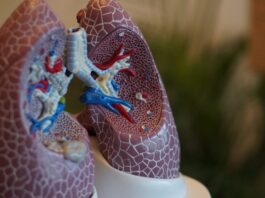 La anamicina para metástasis pulmonares de sarcoma tejido blando obtuvo designación de vía rápida
