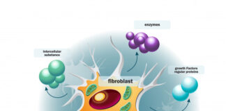 Las células fibroblásticas perivasculares podrían explicar origen y dinámica imprevisibles de la esclerosis lateral amiotrófica