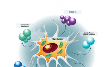 Las células fibroblásticas perivasculares podrían explicar origen y dinámica imprevisibles de la esclerosis lateral amiotrófica