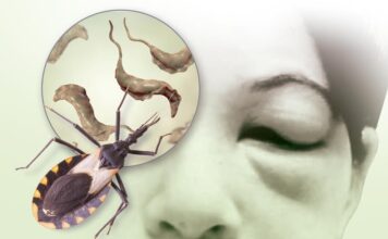 El chagas afecta más a los más marginados