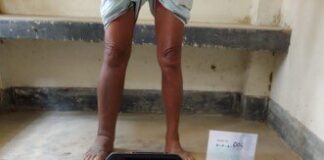 Imágenes térmicas infrarrojas como una nueva herramienta no invasiva en el punto de atención para evaluar la filariasis linfática