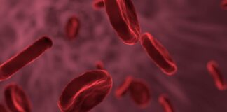 Pozelimab muestra resultados positivos en el tratamiento de la hemoglobinuria paroxística nocturna