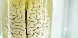 La atrofia del córtex cerebral se relaciona con apatía en pacientes de Huntington