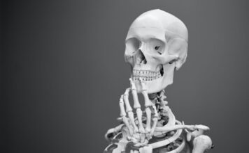 La mifamurtida para el osteosarcoma mejora las tasas de supervivencia