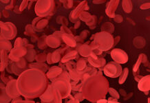 Detección de cadena ligera de neurofilamentos en sangre puede facilitar diagnóstico de enfermedades neurodegenerativas