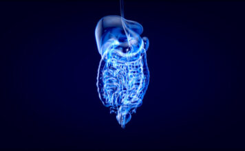 Etrasimod obtuvo el estatus de fármaco huérfano para esofagitis eosinofílica