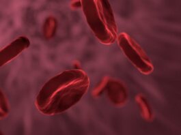 Pozelimab muestra resultados positivos en el tratamiento de la hemoglobinuria paroxística nocturna