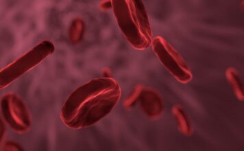 Pozelimab muestra resultados positivos en el tratamiento de la hemoglobinuria paroxística nocturna