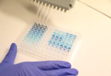 ‘Súper ensayos’ rápidos y baratos para detectar la malaria