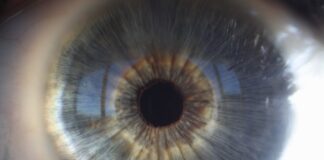 Un nuevo estudio ayuda a comprender las bases moleculares de las distrofias hereditarias de retina causadas por el gen ‘CERKL’