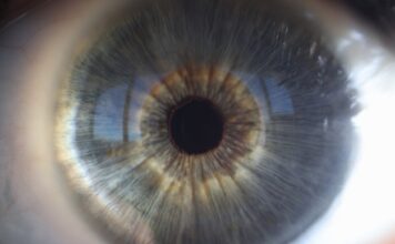 Un nuevo estudio ayuda a comprender las bases moleculares de las distrofias hereditarias de retina causadas por el gen ‘CERKL’