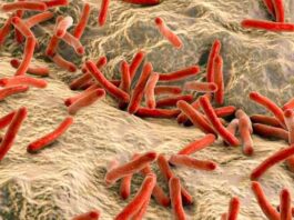 Un prometedor biomarcador de sangre total para ayudar al control de la lepra