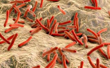 Un prometedor biomarcador de sangre total para ayudar al control de la lepra