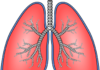 El estudio colaborativo proporciona una mayor comprensión de la fibrosis pulmonar idiopática