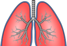 El estudio colaborativo proporciona una mayor comprensión de la fibrosis pulmonar idiopática