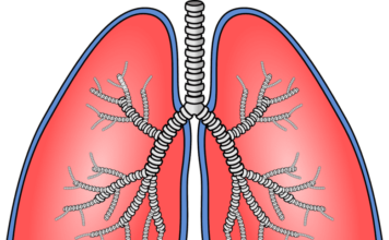 El estudio colaborativo proporciona una mayor comprensión de la fibrosis pulmonar idiopática
