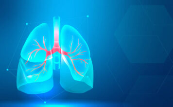 Desentrañando los misterios de una rara enfermedad, la linfangioleiomiomatosis