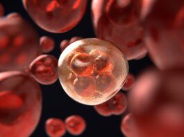 Hallazgos provisionales positivos de ensayo inicial para anemia de células falciformes